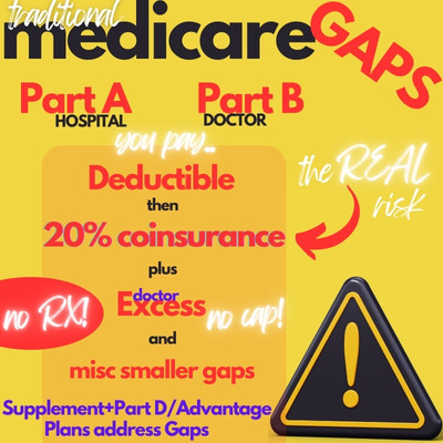 what are the gaps in medicare that the F and G plan cover